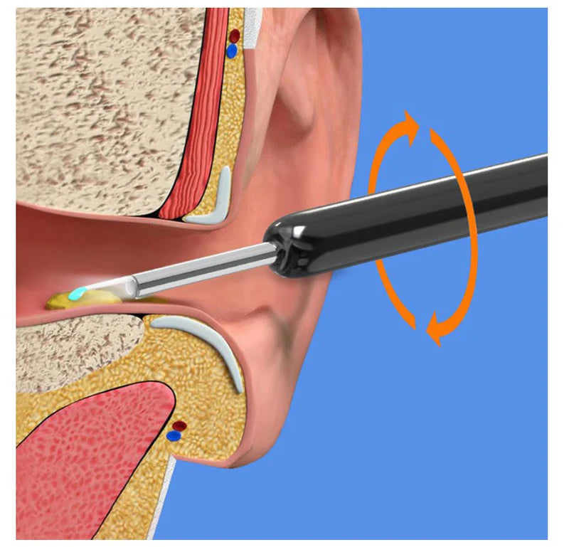 Earwax Removal Kit  منظف شمع الأذن الذكي