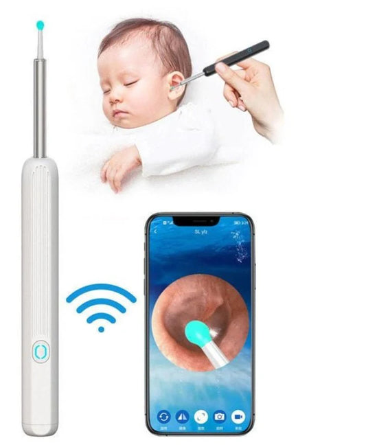 Earwax Removal Kit  منظف شمع الأذن الذكي
