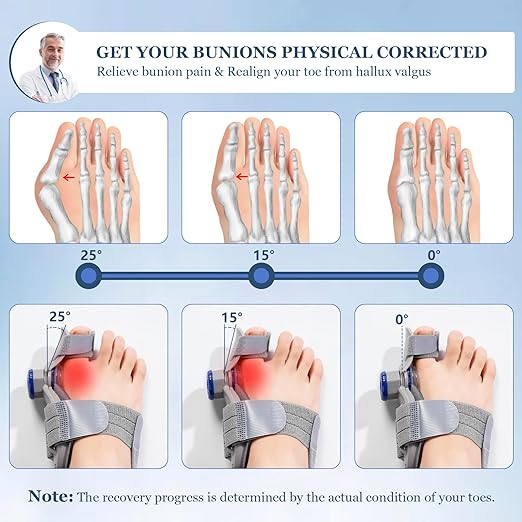 Bunion Corrector   مصحح انحراف إبهام القدم
