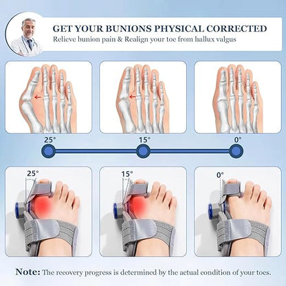 Bunion Corrector   مصحح انحراف إبهام القدم