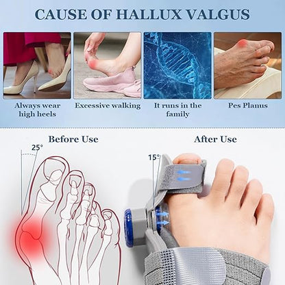 Bunion Corrector   مصحح انحراف إبهام القدم
