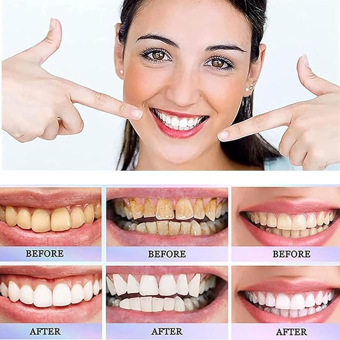 Dazzle White Toothpaste معجون تبييض الأسنان المتطور