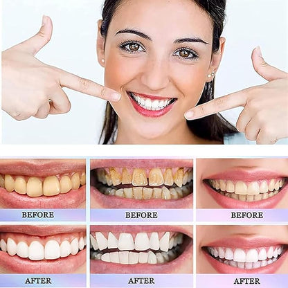 Dazzle White Toothpaste معجون تبييض الأسنان المتطور