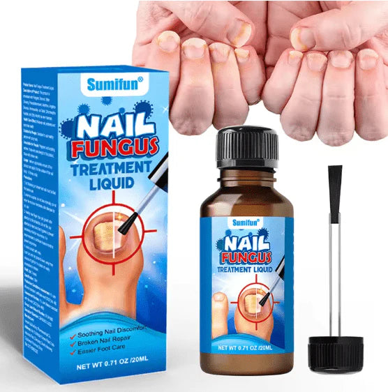 Nail Fungus Treatment Liquid  علاج فطريات الأظافر