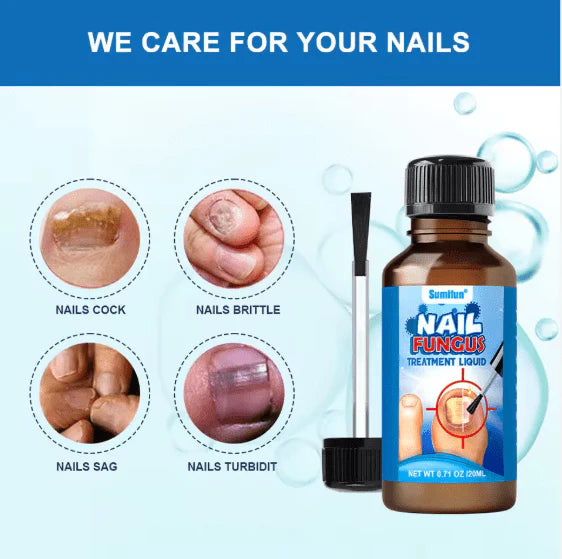 Nail Fungus Treatment Liquid  علاج فطريات الأظافر